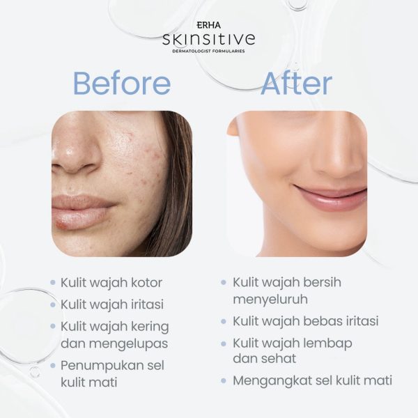 ERHA Skinsitive Ultracalm Face Wash 80g - Sabun Wajah Sensitif & Aman untuk Semua Jenis Kulit - Image 4