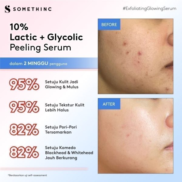 SOMETHINC 10% Lactic + Glycolic Peeling Serum - Image 4
