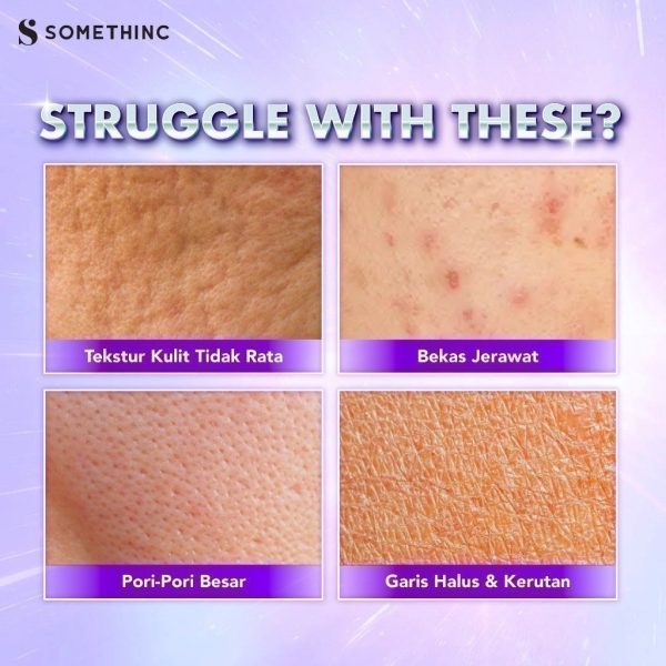 [NEW LAUNCH] SOMETHINC BioSpicule Renewal Serum - Image 6