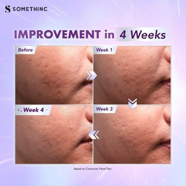 [NEW LAUNCH] SOMETHINC BioSpicule Renewal Serum - Image 7